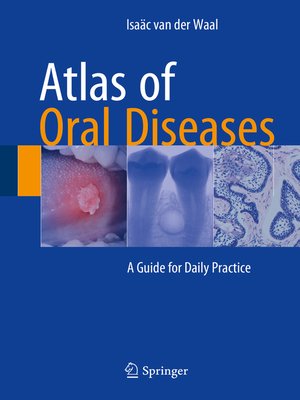 cover image of Atlas of Oral Diseases